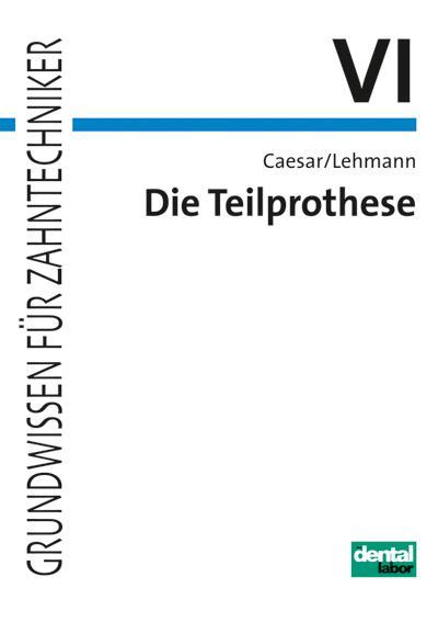 Die Teilprothese