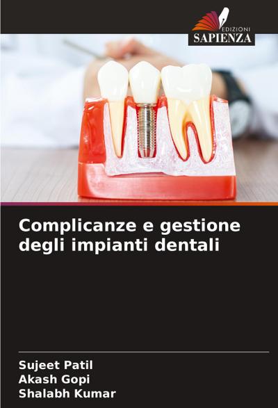 Complicanze e gestione degli impianti dentali