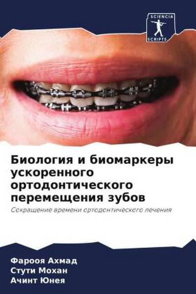 Biologiq i biomarkery uskorennogo ortodonticheskogo peremescheniq zubow