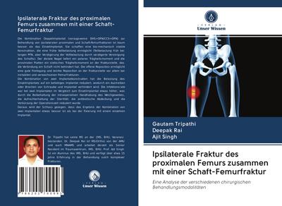 Ipsilaterale Fraktur des proximalen Femurs zusammen mit einer Schaft-Femurfraktur