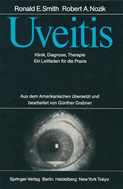 Uveitis
