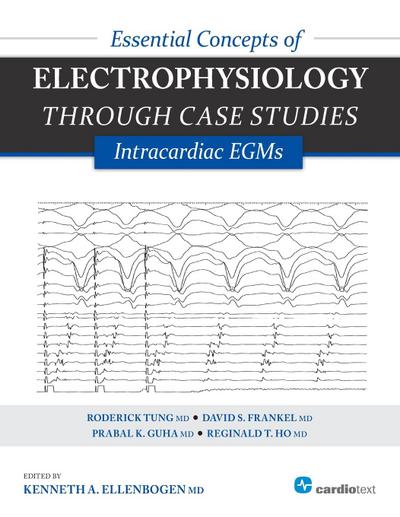 Essential Concepts of Electrophysiology Through Case Studies