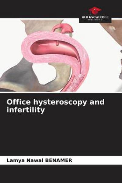 Office hysteroscopy and infertility