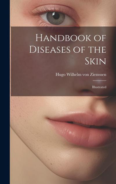 Handbook of Diseases of the Skin; Illustrated