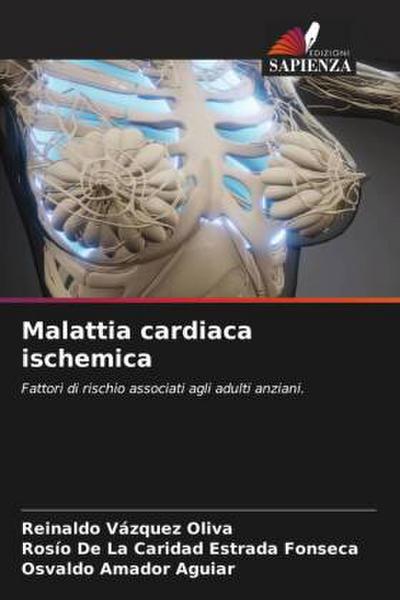 Malattia cardiaca ischemica