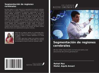 Segmentación de regiones cerebrales