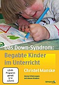 Das Down-Syndrom - Begabte Kinder im Unterricht