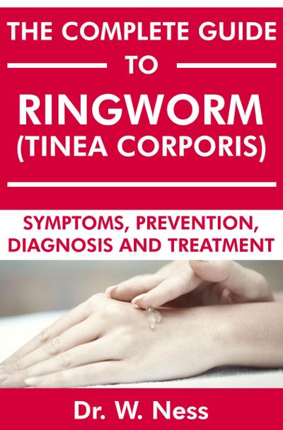 The Complete Guide to Ringworm (Tinea Corporis): Symptoms, Prevention, Diagnosis and Treatment