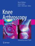 Knee Arthroscopy