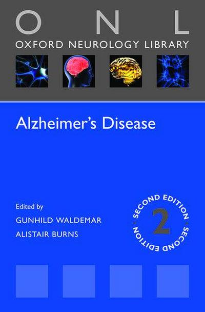 Alzheimer’s Disease