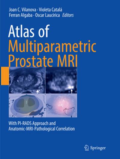 Atlas of Multiparametric Prostate MRI