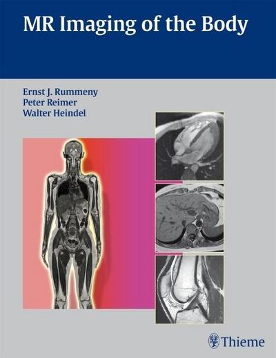 Whole Body MR Imaging