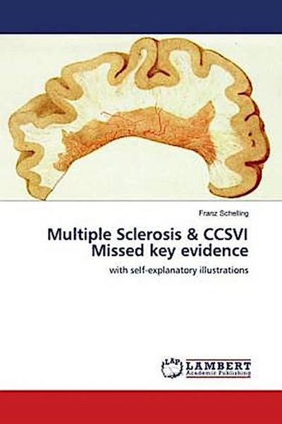 Multiple Sclerosis & CCSVI Missed key evidence
