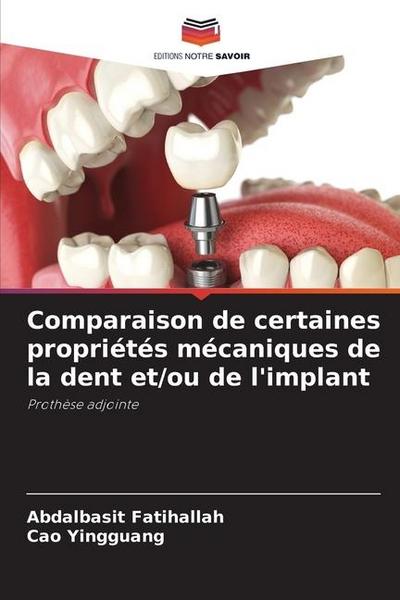 Comparaison de certaines propriétés mécaniques de la dent et/ou de l’implant