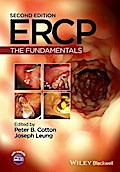 ERCP