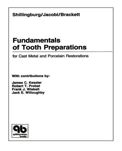 Fundamentals of Tooth Preparations for Cast Metal and Porcelain Restorations (eBook, EPUB) - Herbert T Shillingburg