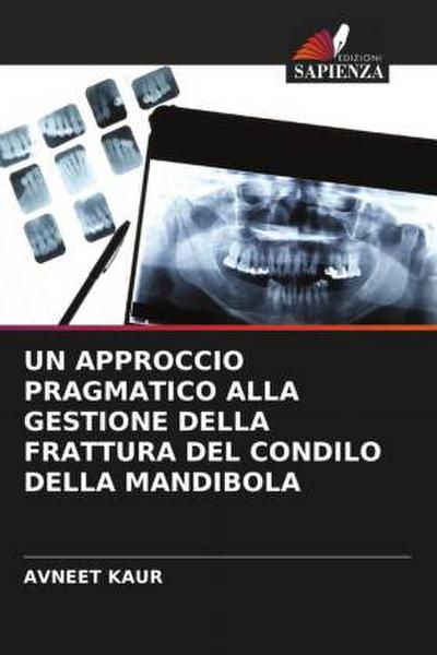 UN APPROCCIO PRAGMATICO ALLA GESTIONE DELLA FRATTURA DEL CONDILO DELLA MANDIBOLA