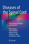 Diseases of the Spinal Cord