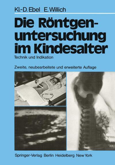 Die Röntgenuntersuchung im Kindesalter