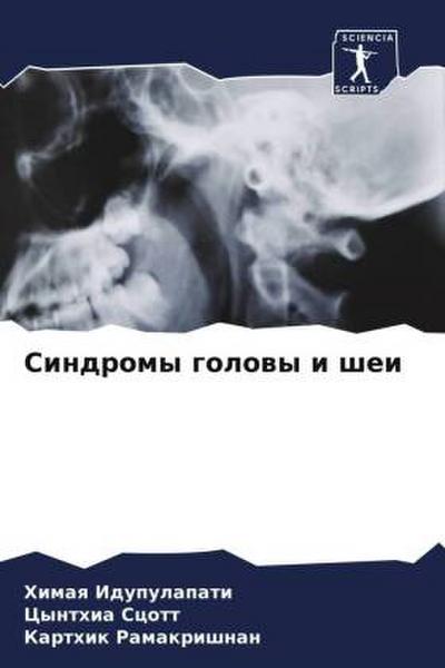 Sindromy golowy i shei