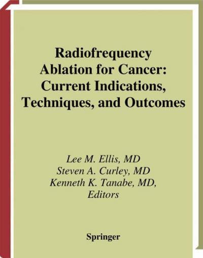 Radiofrequency Ablation for Cancer