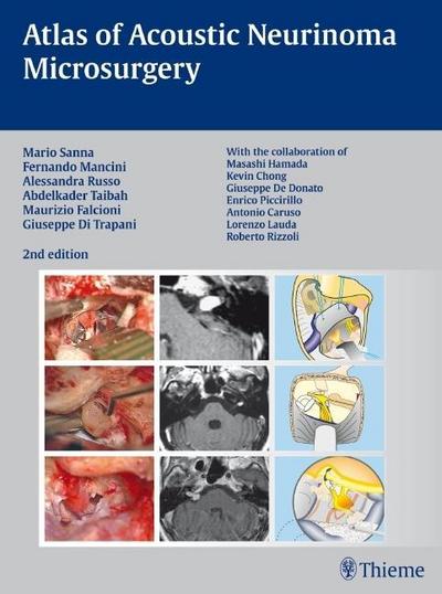 Atlas of Acoustic Neurinoma Microsurgery