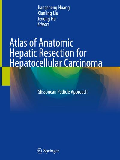 Atlas of Anatomic Hepatic Resection for Hepatocellular Carcinoma