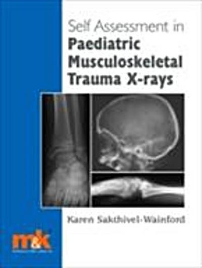 Self-assessment in Paediatric Musculoskeletal Trauma X-rays