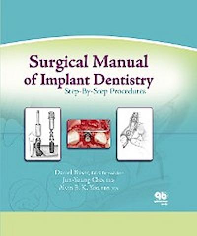 Surgical Manual of Implant Dentistry