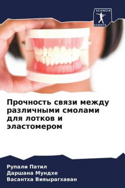 Prochnost’ swqzi mezhdu razlichnymi smolami dlq lotkow i älastomerom