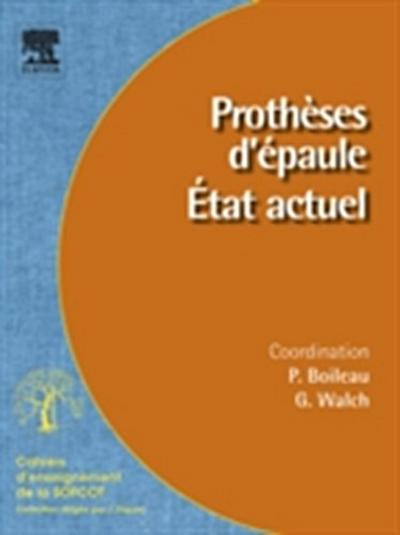 Protheses d’epaule. Etat actuel