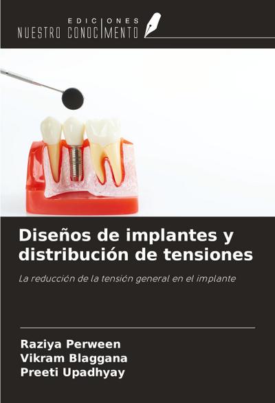 Diseños de implantes y distribución de tensiones