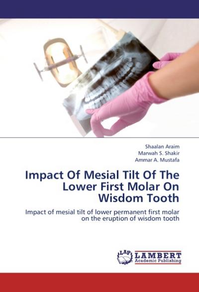 Impact Of Mesial Tilt Of The Lower First Molar On Wisdom Tooth