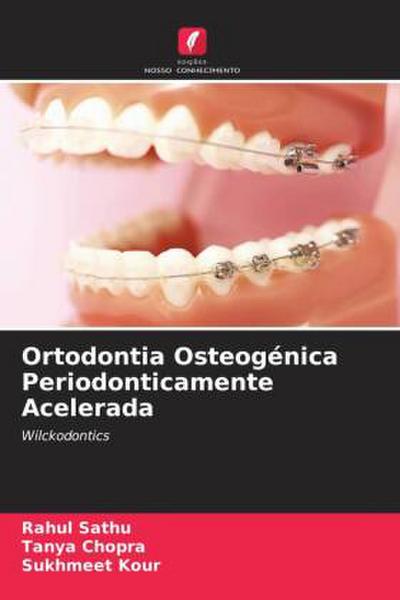 Ortodontia Osteogénica Periodonticamente Acelerada