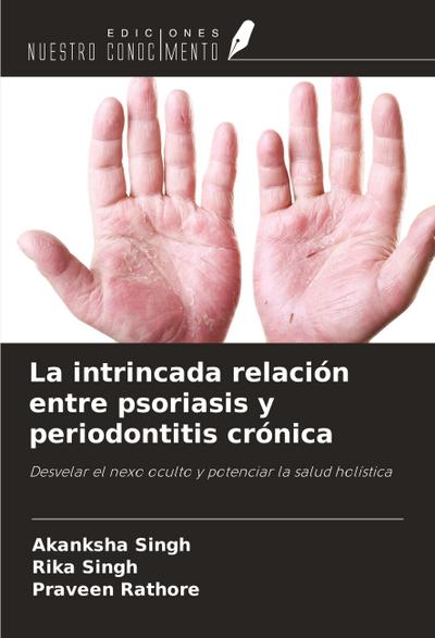 La intrincada relación entre psoriasis y periodontitis crónica