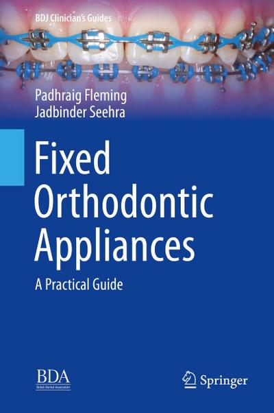Fixed Orthodontic Appliances