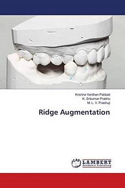 Ridge Augmentation