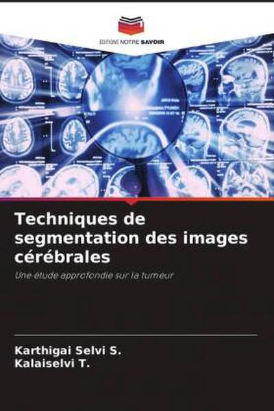 Techniques de segmentation des images cérébrales