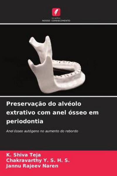 Preservação do alvéolo extrativo com anel ósseo em periodontia