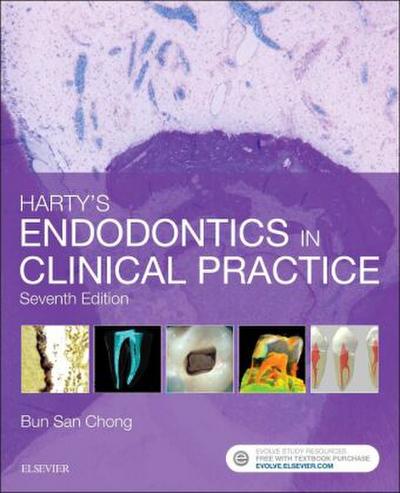 Harty’s Endodontics in Clinical Practice