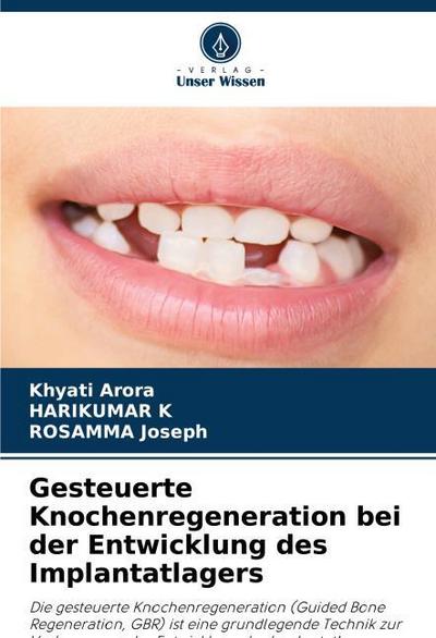 Gesteuerte Knochenregeneration bei der Entwicklung des Implantatlagers