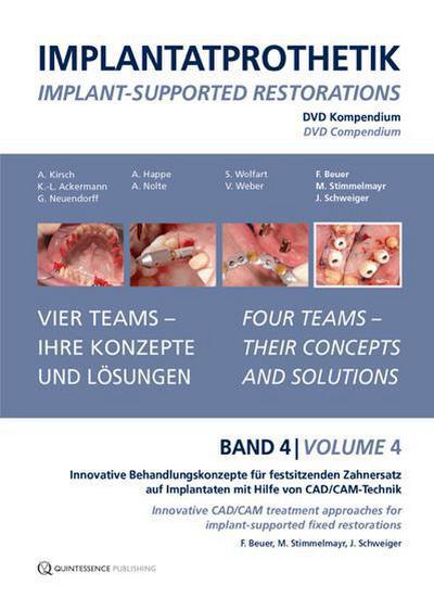 Implantatprothetik. DVD, Band 4