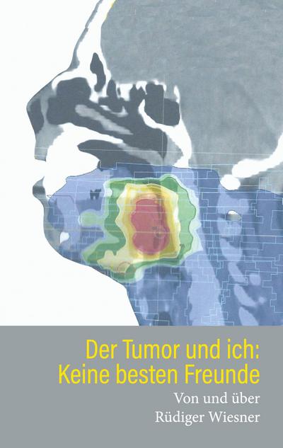 Der Tumor und Ich: Keine besten Freunde