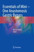 Essentials of Mini One Anastomosis Gastric Bypass