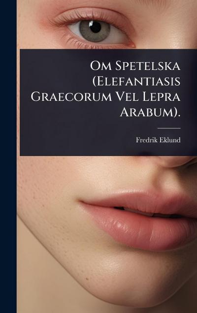 Om Spetelska (Elefantiasis Graecorum Vel Lepra Arabum).