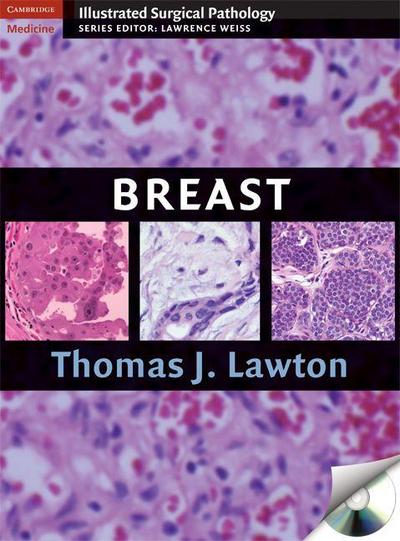 Illustrated Surgical Pathology of the Breast