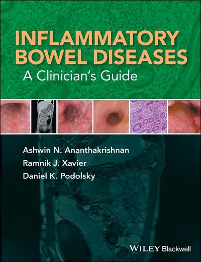 Inflammatory Bowel Diseases