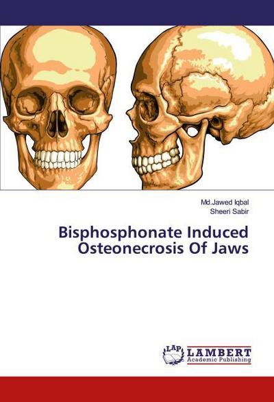 Bisphosphonate Induced Osteonecrosis Of Jaws