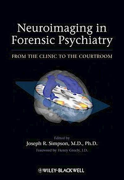 Neuroimaging in Forensic Psychiatry