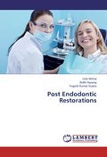 Post Endodontic Restorations